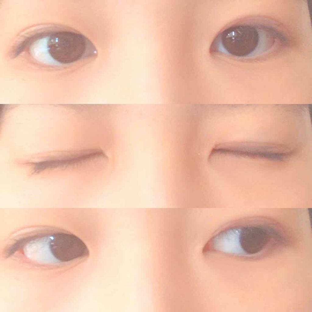 アイビューティー フィクサー WP/アストレア ヴィルゴ/二重まぶた用アイテムを使ったクチコミ（2枚目）