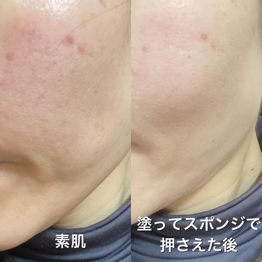 Wエッセンス/shimaboshi/美容液を使ったクチコミ（2枚目）