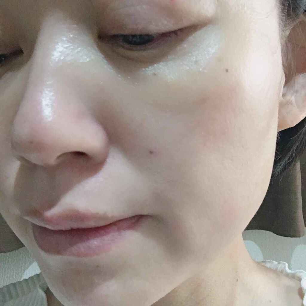 トラブルリペア リキッド/アルージェ/美容液を使ったクチコミ(4枚目)