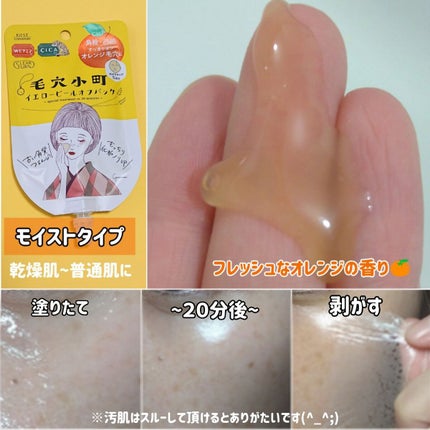 毛穴小町 イエローピールオフパック/クリアターン/ピーリングを使ったクチコミ(2枚目)
