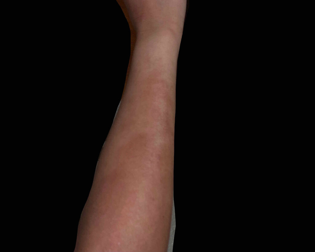 フレッシュリージュースドビタミンドロップ(35ml)/Klairs/美容液を使ったクチコミ（3枚目）