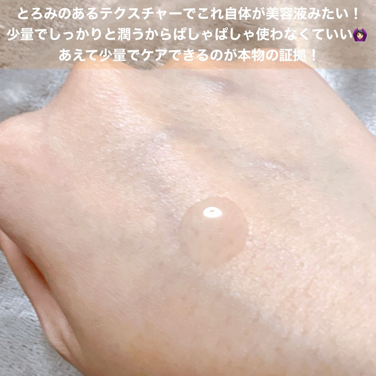エンリッチプラス 化粧液Ⅱ しっとり <医薬部外品>/ファンケル/化粧水を使ったクチコミ(3枚目)
