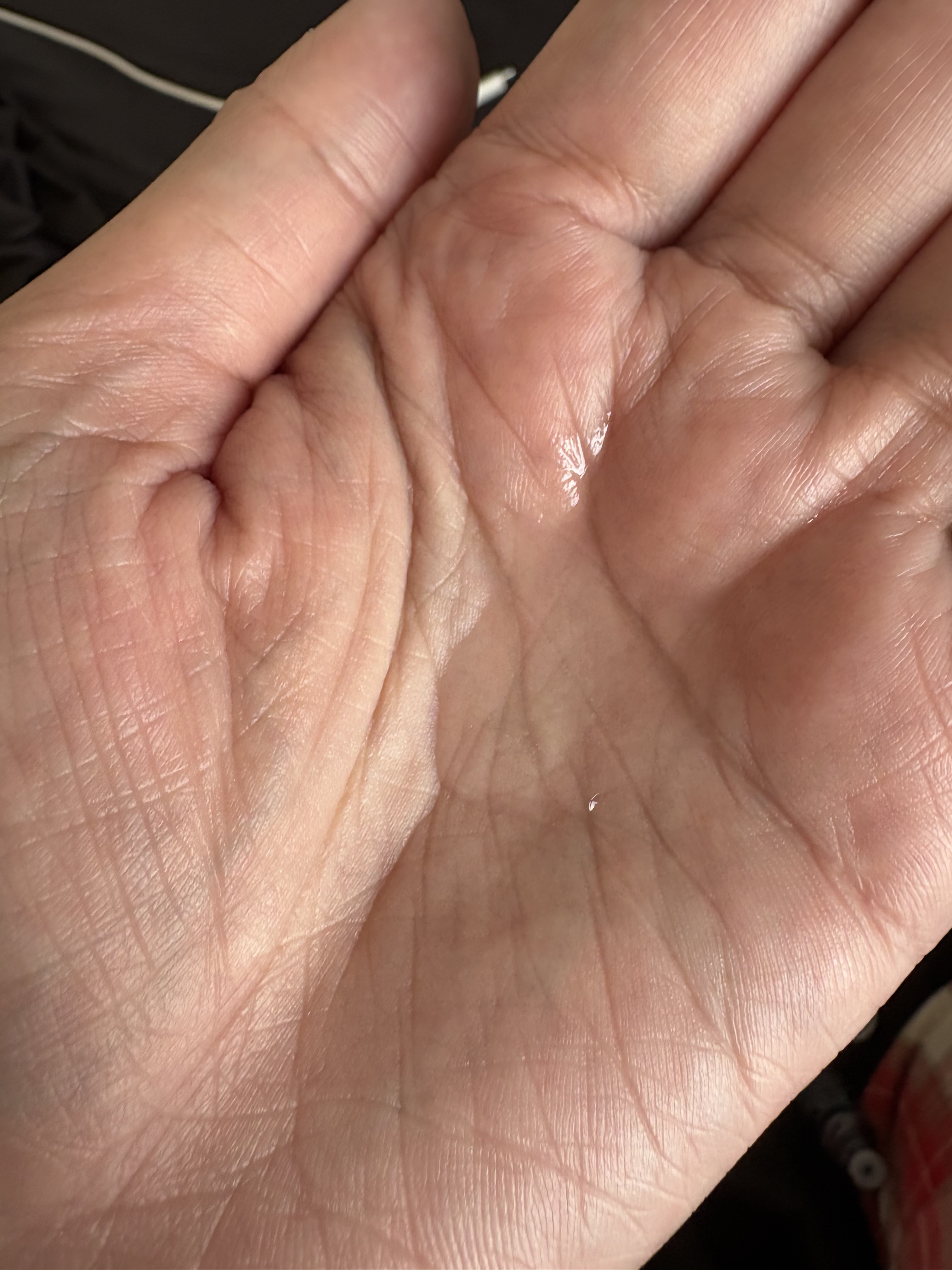 ソナディス ボーテ ローション/アルソア/化粧水を使ったクチコミ（2枚目）