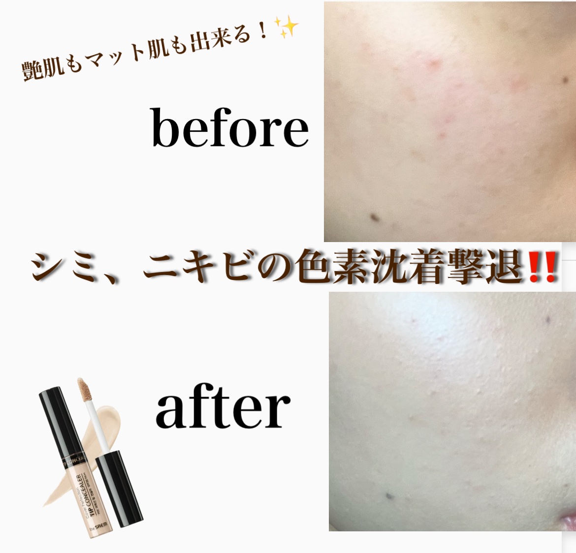 カバーパーフェクション チップコンシーラー/the SAEM/リキッドコンシーラーを使ったクチコミ（1枚目）