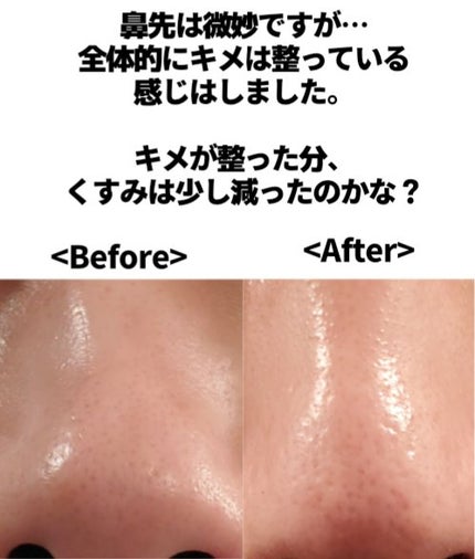 RXザ・ビタミンC23セラム/COSRX/美容液を使ったクチコミ(3枚目)