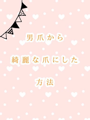 こんにちはこんばんわおはようございます！
しのあです！|･ω･)ﾉ やぽ～| ///|

今回はえぐいほどの男爪だった私が
綺麗と言われるようになった爪＋手のむくみをとる方法

をご紹介します


✼•