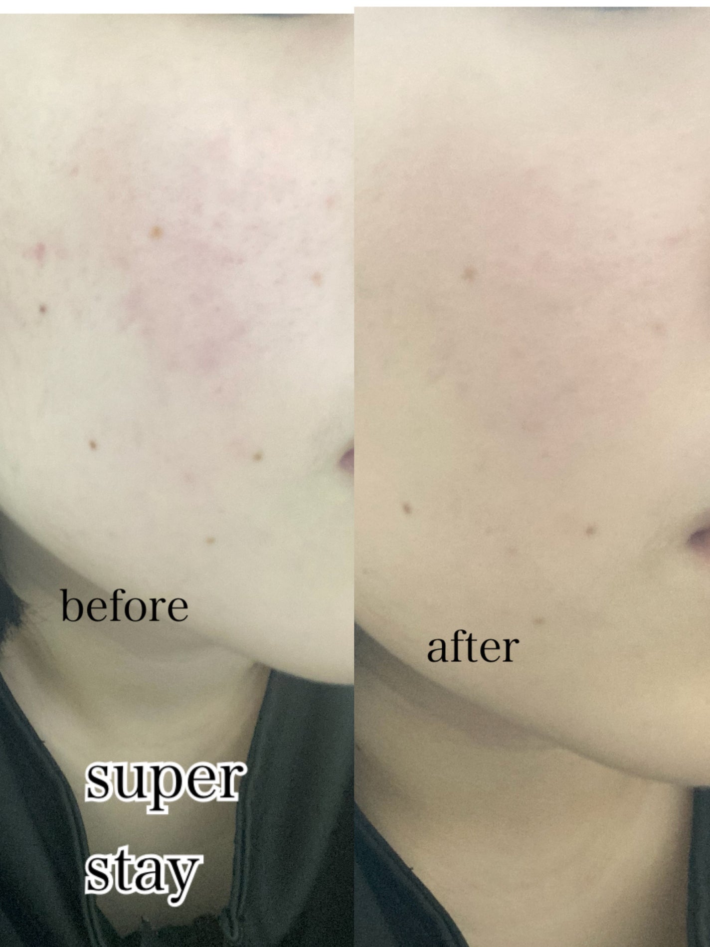 フィットミー リキッドファンデーション R/MAYBELLINE NEW YORK/リキッドファンデーションを使ったクチコミ(5枚目)