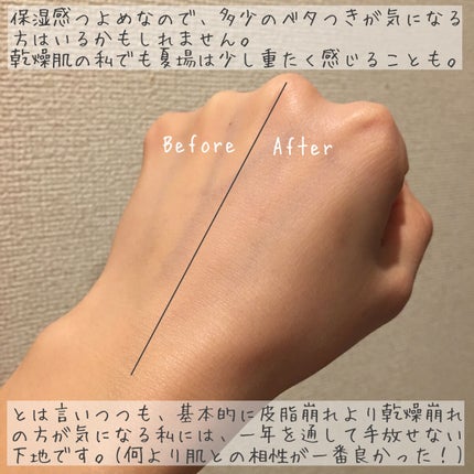 エファクラ ピールケア セラム/ラ ロッシュ ポゼ/美容液を使ったクチコミ(3枚目)