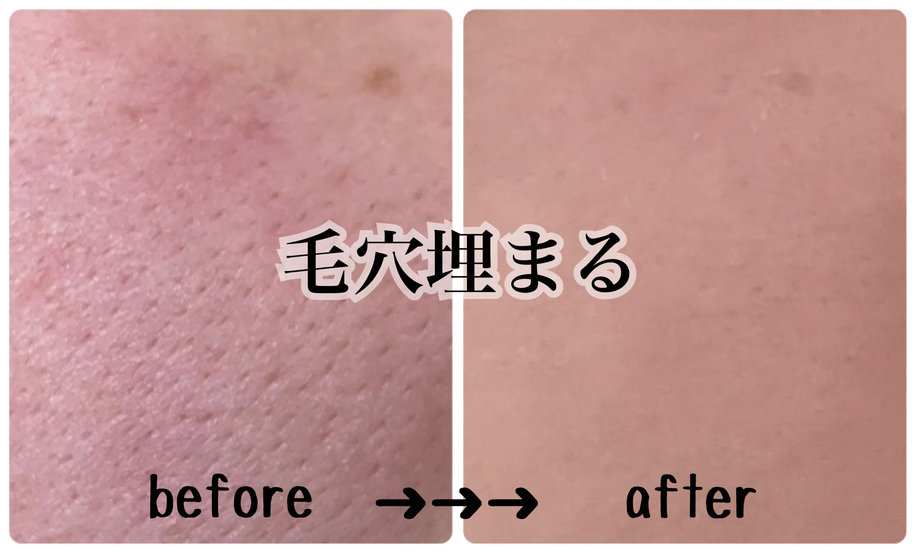 ドラマティックパウダリー EX/マキアージュ/パウダーファンデーションを使ったクチコミ（1枚目）