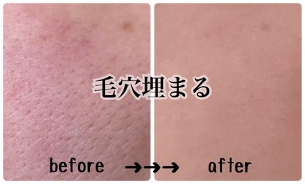 ドラマティックパウダリー EX/マキアージュ/パウダーファンデーションを使ったクチコミ(1枚目)