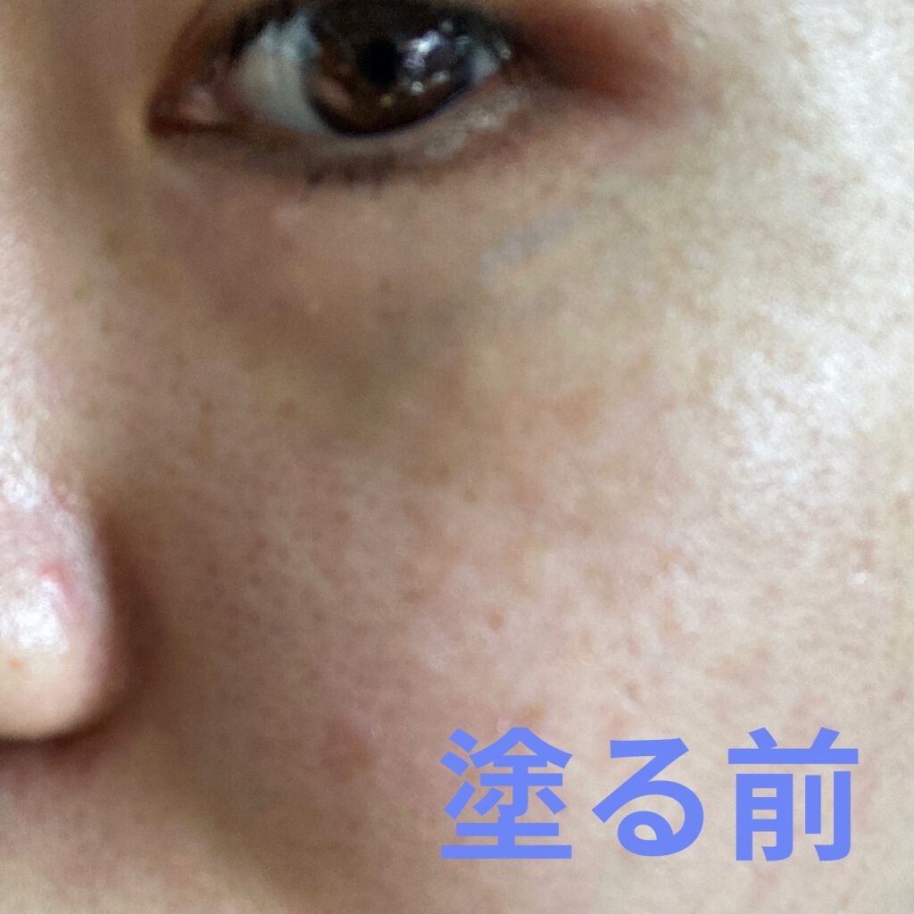 ドクタージャルト シカペア リカバー (第2世代）/Dr.Jart＋/フェイスクリームを使ったクチコミ（2枚目）