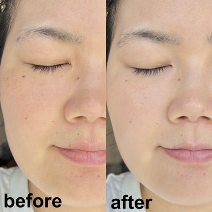 Miki on LIPS 「\エスト史上最強のカバー力/-----------------..」(4枚目)