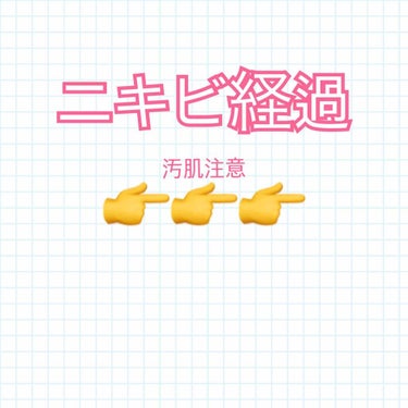 ず/ニキビ治療中 on LIPS 「久々にニキビの経過を載せます。。汚肌注意です⚠️私はニキビ治療..」（1枚目）