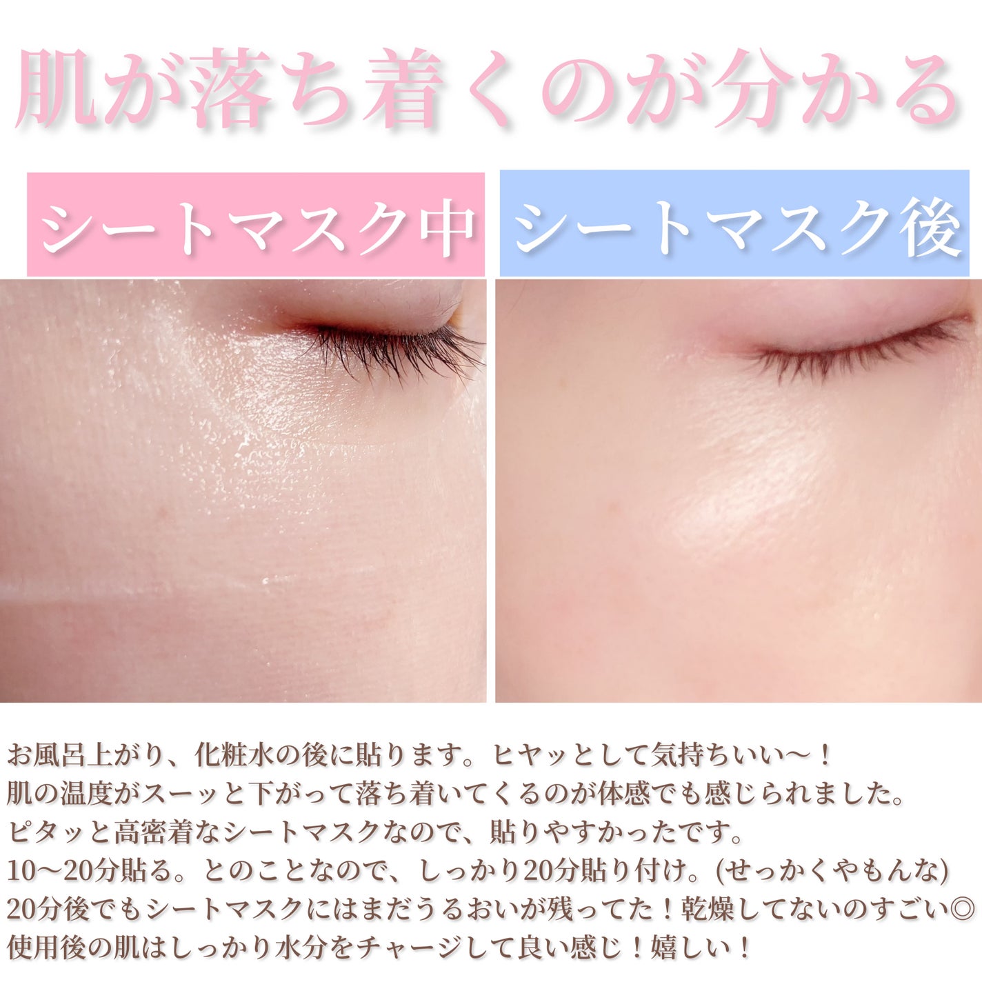 レッドブレミッシュ クールスージングマスク/Dr.G/シートマスク・パックを使ったクチコミ(9枚目)