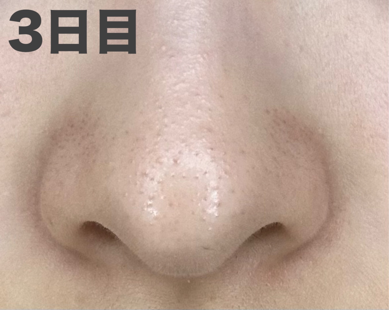 パーフェクトワンフォーカス スムースクレンジングバーム ディープブラック クロミ 限定デザイン（75g）/PERFECT ONE  FOCUS/クレンジングバームを使ったクチコミ（2枚目）