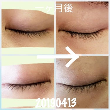 スカルプD ボーテ ピュアフリーアイラッシュセラム プレミアム