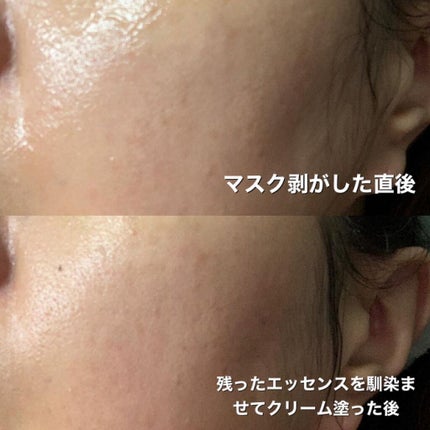 Big3 Step Whitening Mask Pack/MIGUHARA/シートマスク・パックを使ったクチコミ(10枚目)