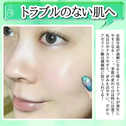 アゼライン酸15 インテンスカーミングセラム/Anua/美容液を使ったクチコミ(6枚目)