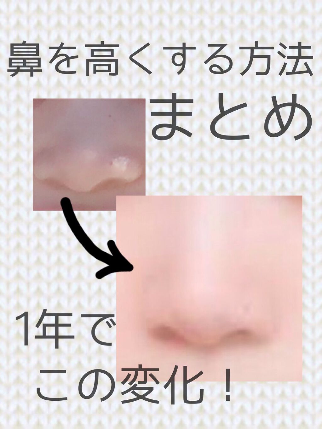 ハトムギ保湿ジェル(ナチュリエ スキンコンディショニングジェル)/ナチュリエ/美容液を使ったクチコミ（1枚目）