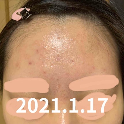 モイスチャージェル2/エンビロン/フェイスクリームを使ったクチコミ(4枚目)