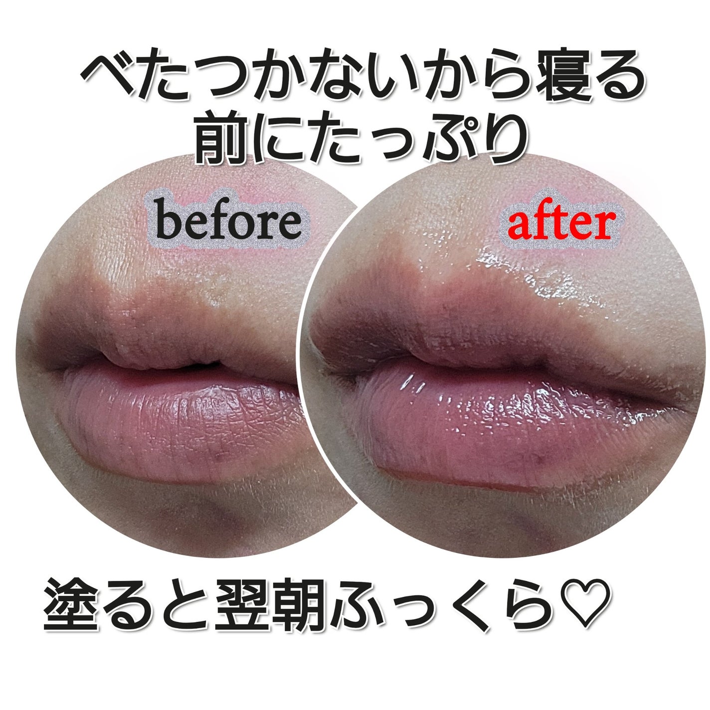 イリュン コラーゲンモイスチャーリップマスク/illuN/リップマスクを使ったクチコミ(5枚目)