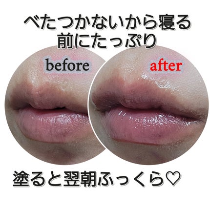 イリュン コラーゲンモイスチャーリップマスク/illuN/リップマスクを使ったクチコミ(5枚目)