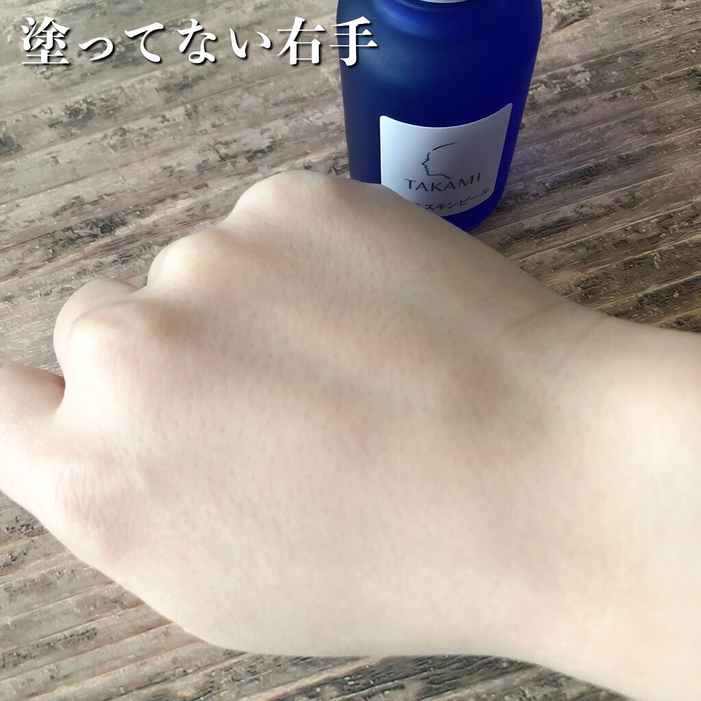 タカミスキンピール/タカミ/ブースター・導入液を使ったクチコミ(5枚目)