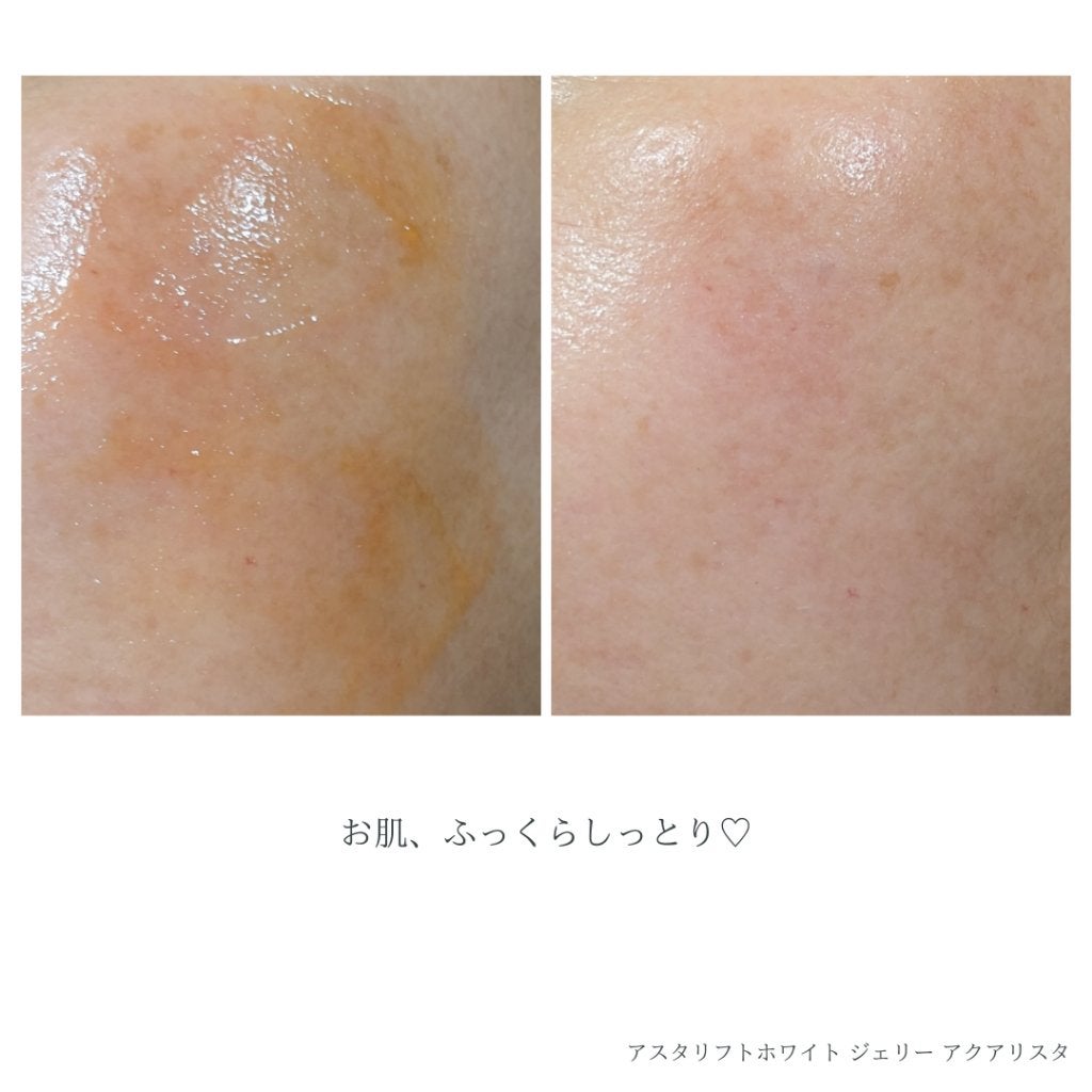 アスタリフト ホワイト ジェリー アクアリスタ/アスタリフト/美容液を使ったクチコミ(7枚目)