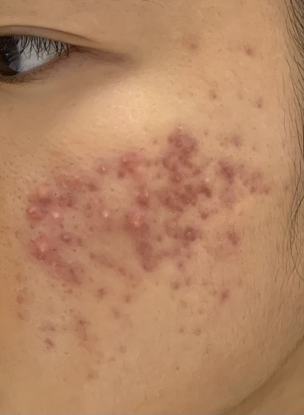 DHC マルチビタミン/DHC/美容サプリメントを使ったクチコミ（3枚目）