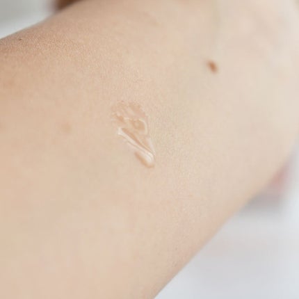 バイオイル/バイオイル/フェイスオイルを使ったクチコミ(3枚目)