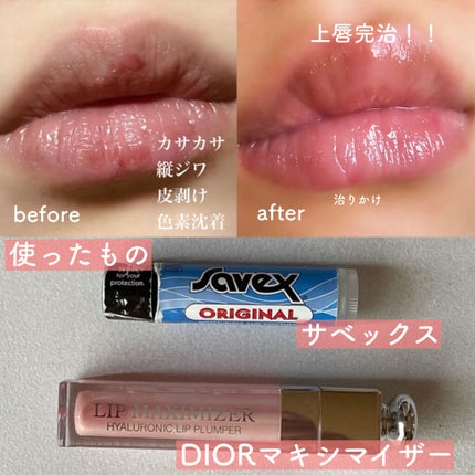 【旧】ディオール アディクト リップ マキシマイザー/Dior/リップグロスを使ったクチコミ(2枚目)