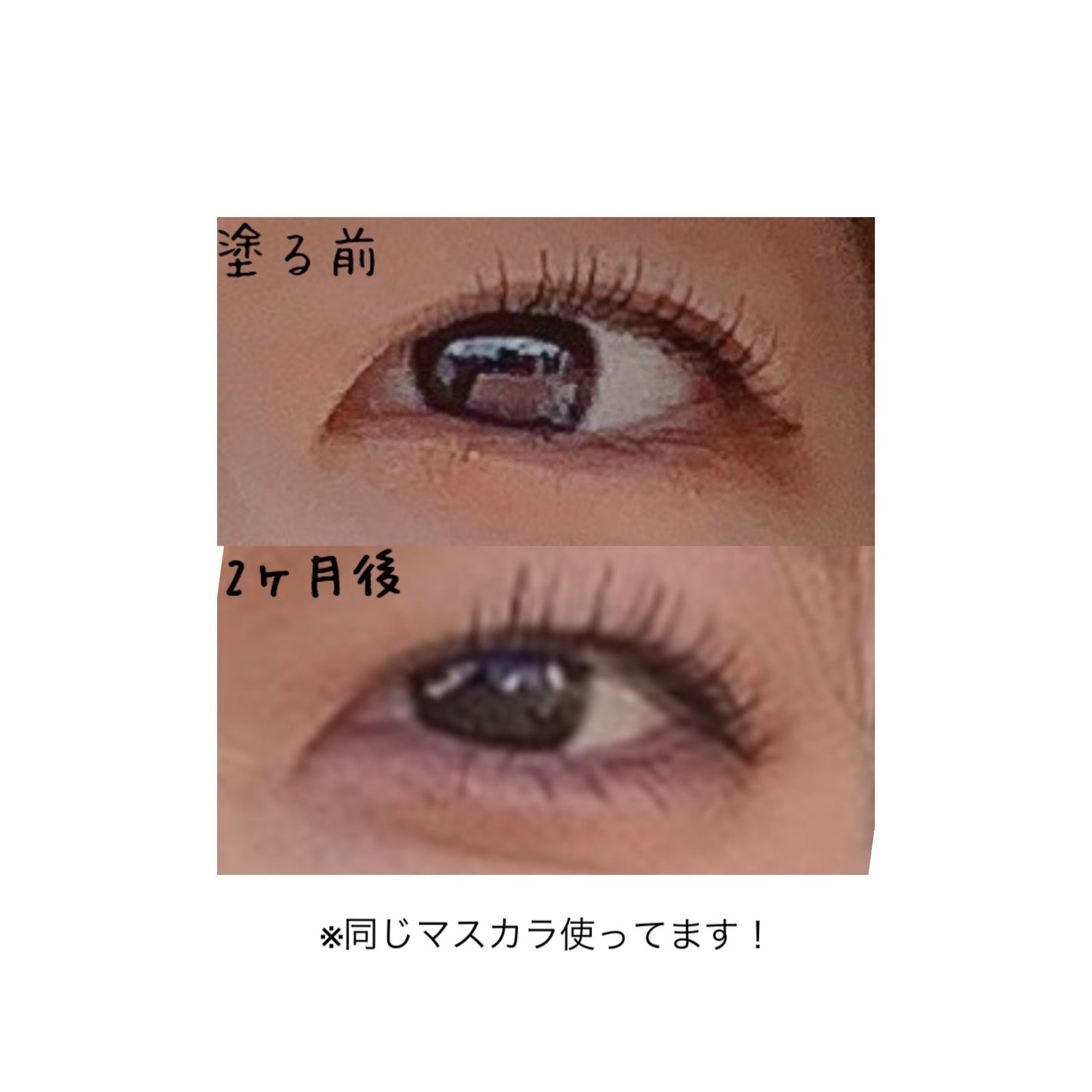EMAKED(エマーキット)|水橋保寿堂製薬の使い方を徹底解説 EMAKED(エマーキット)|水橋保寿堂製薬の使い方を徹底解説