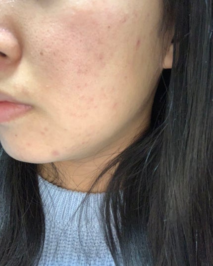 スキンケア洗顔料 リッチモイスチャー/ビオレ/洗顔フォームを使ったクチコミ(1枚目)