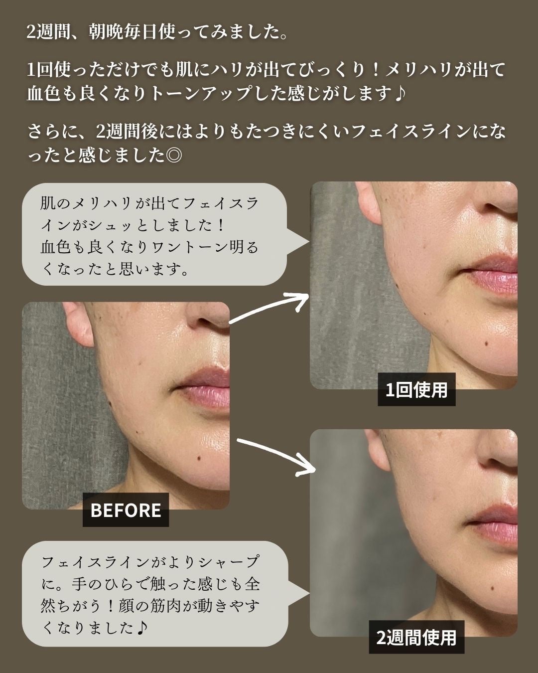 Beauty Face Stick 2.0/STELLA BEAUTE/美顔器・マッサージを使ったクチコミ(8枚目)