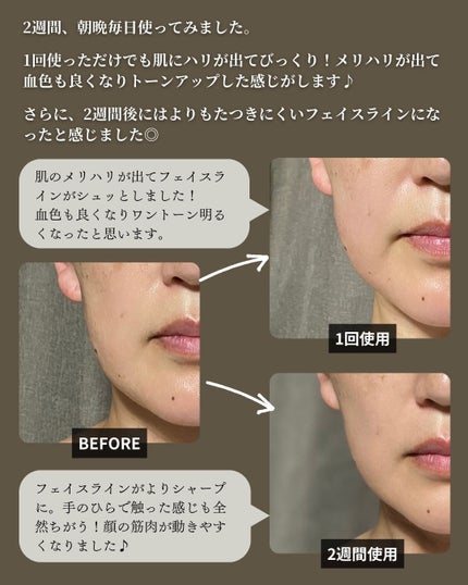 Beauty Face Stick 2.0/STELLA BEAUTE/美顔器・マッサージを使ったクチコミ(8枚目)