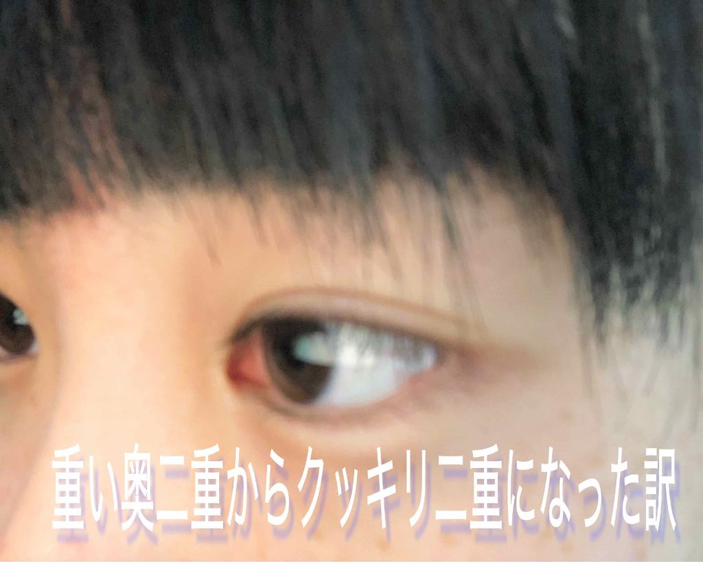 アイトーク/アイトーク/二重まぶた用アイテムを使ったクチコミ(1枚目)