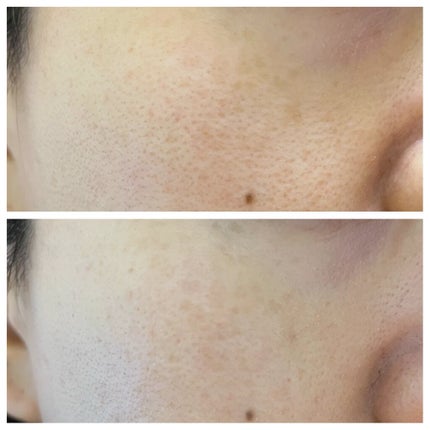 ヴィーガン カラーファンデーション/Veauty by THE_B/リキッドファンデーションを使ったクチコミ(7枚目)