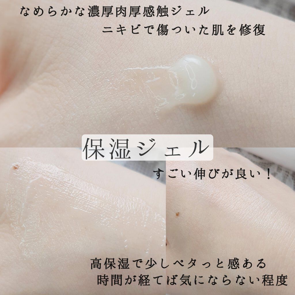 薬用Rエッセンス/HIN アクネスラボ/美容液を使ったクチコミ(5枚目)