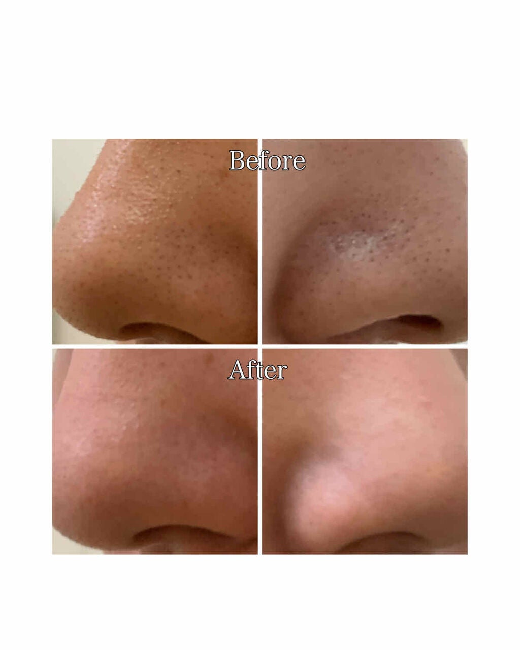 ホホバオイル/無印良品/ボディオイルを使ったクチコミ(2枚目)