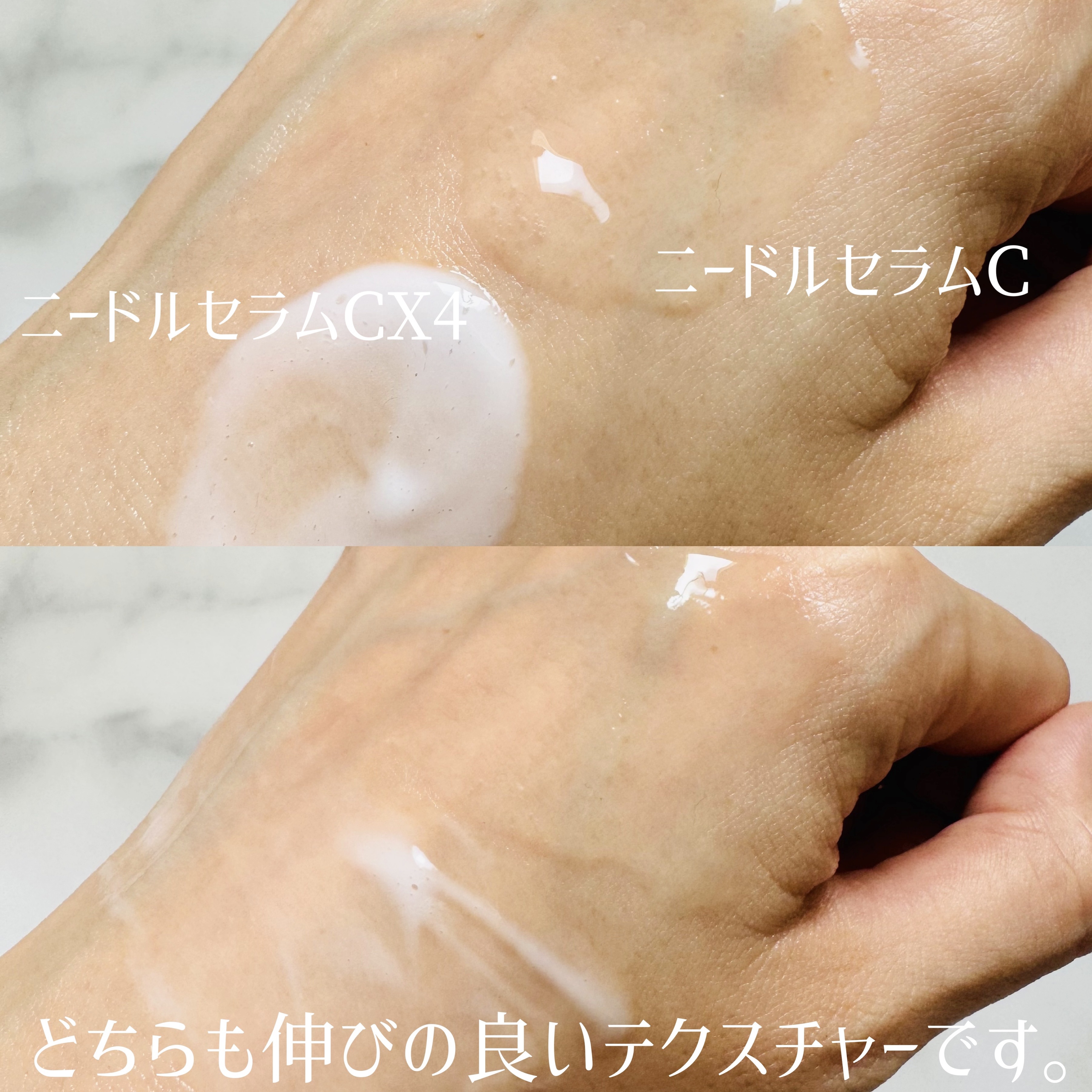 ニードルセラムCX4/fractionalCC/美容液を使ったクチコミ（3枚目）