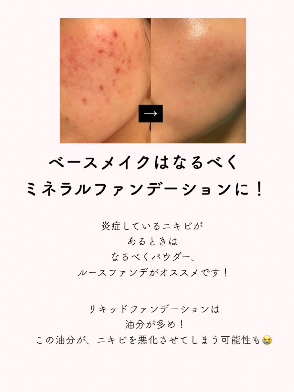 ミネラルシルクファンデーション（ケース・パフ付）/ヴァントルテ/パウダーファンデーションを使ったクチコミ（2枚目）