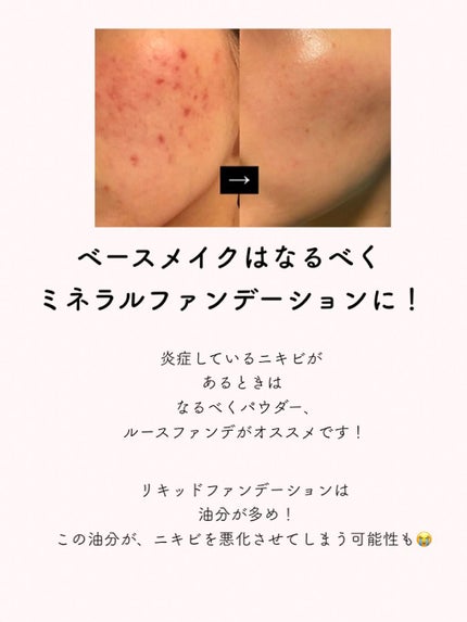 ミネラルシルクファンデーション(ケース・パフ付)/ヴァントルテ/パウダーファンデーションを使ったクチコミ(2枚目)