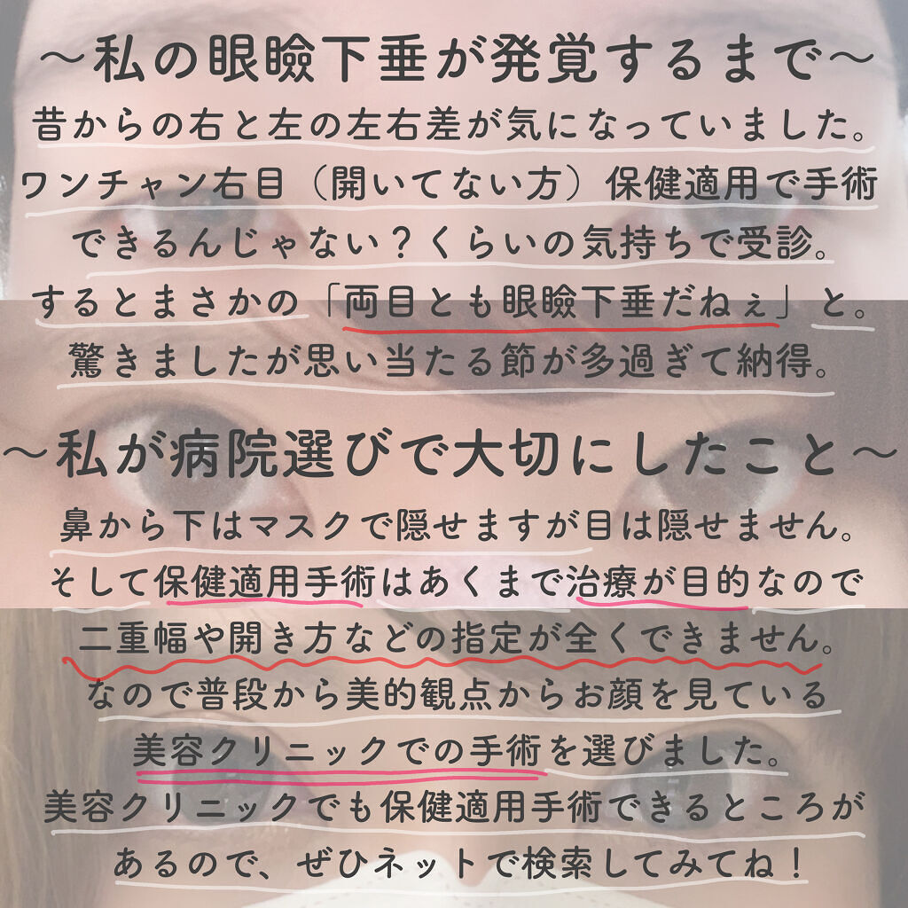 Fabulous(ファビュラス）1month/FABUROUS/カラーコンタクトレンズを使ったクチコミ（2枚目）