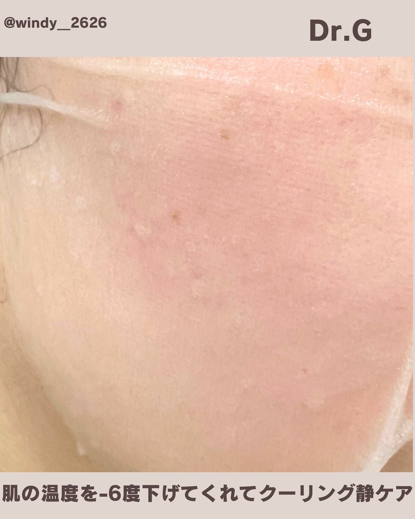 レッドブレミッシュ クールスージングマスク/Dr.G/シートマスク・パックを使ったクチコミ(8枚目)