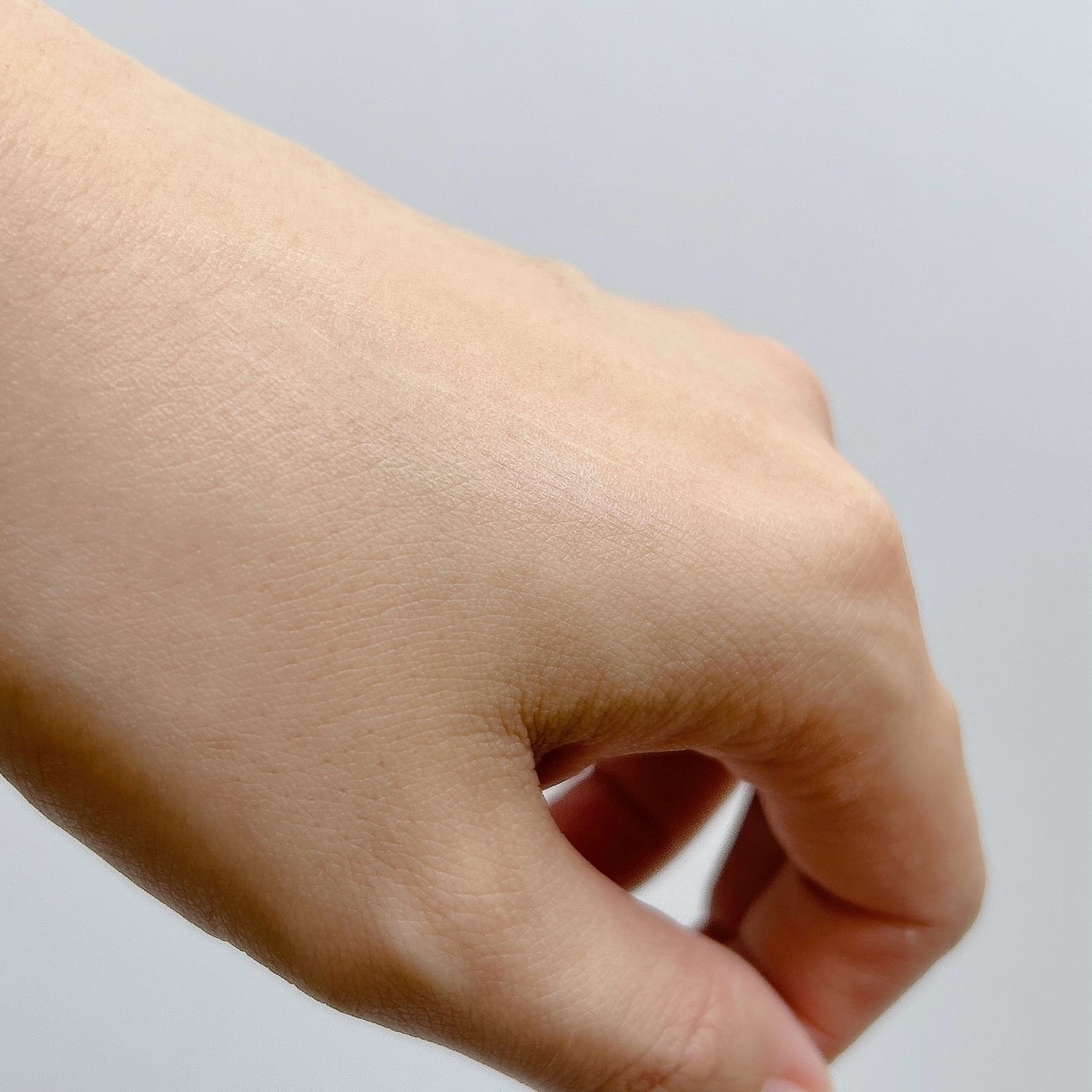 シカスポットクリーム/NATURAL DERMA PROJECT/フェイスクリームを使ったクチコミ(4枚目)