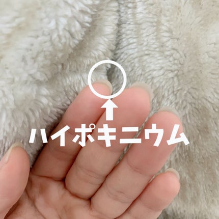 アロマキューティクルオイル/D-UP/ネイルオイル・トリートメントを使ったクチコミ(4枚目)