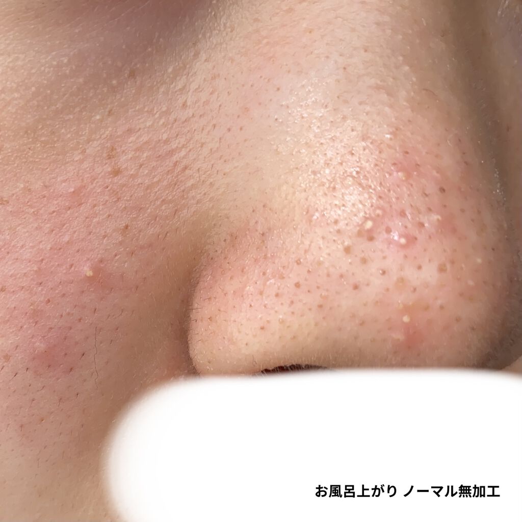 素肌のしずく/アサヒ飲料/化粧水を使ったクチコミ（2枚目）