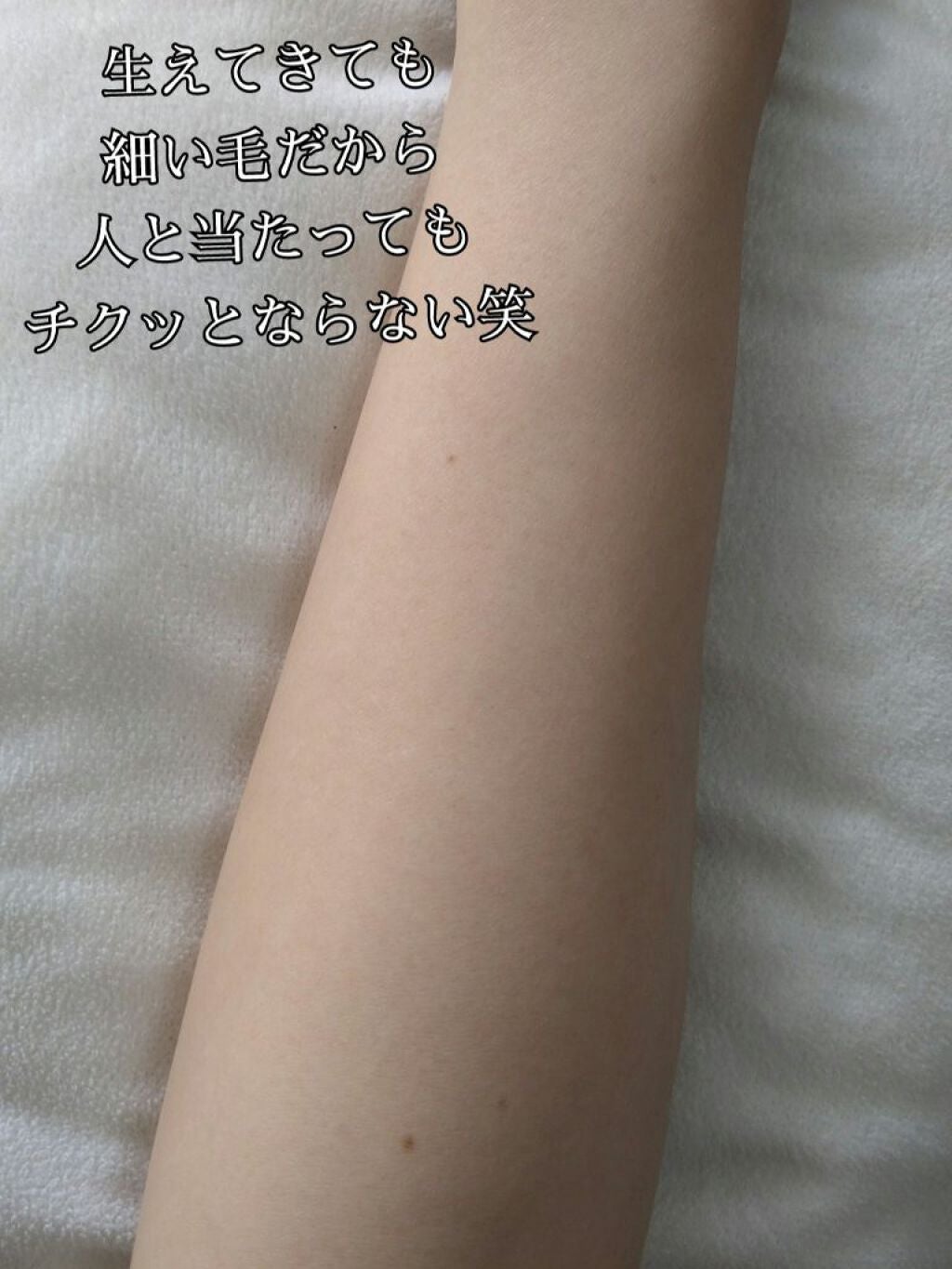 光美容器KE-NON(ケノン)/エムテック/家庭用脱毛器を使ったクチコミ(4枚目)