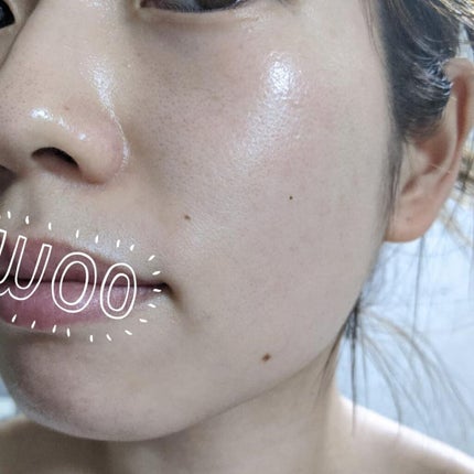 Ascorbic Acid 8% + Alpha Arbutin 2%/The Ordinary/美容液を使ったクチコミ(2枚目)