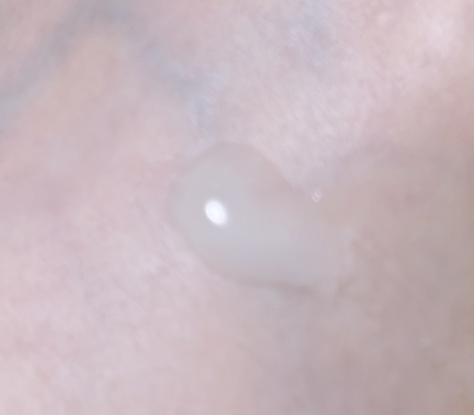 角質除去フットピーリング/One-day's you/ピーリングを使ったクチコミ（2枚目）